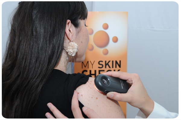 Vuelve My Skin Check, campaña prevencion cáncer de piel 3
